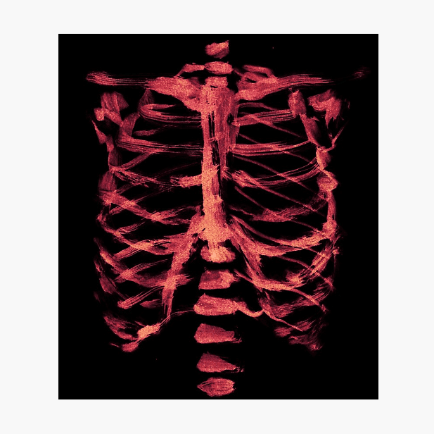 the x-ray film of a human's ribcage