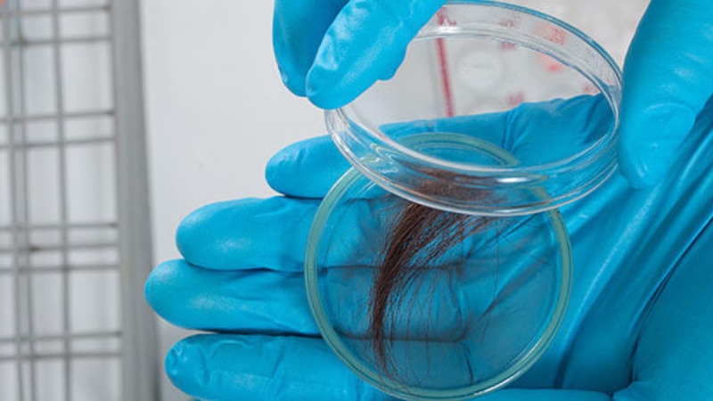 An EtG Hair Follicle test